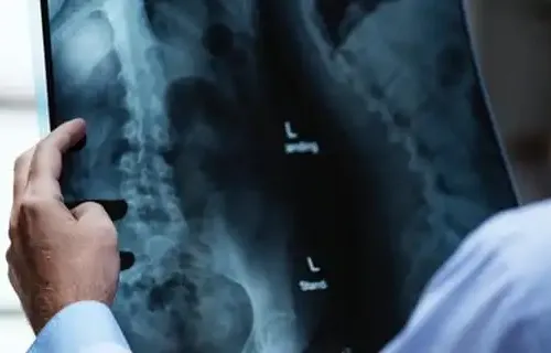 Radiologista